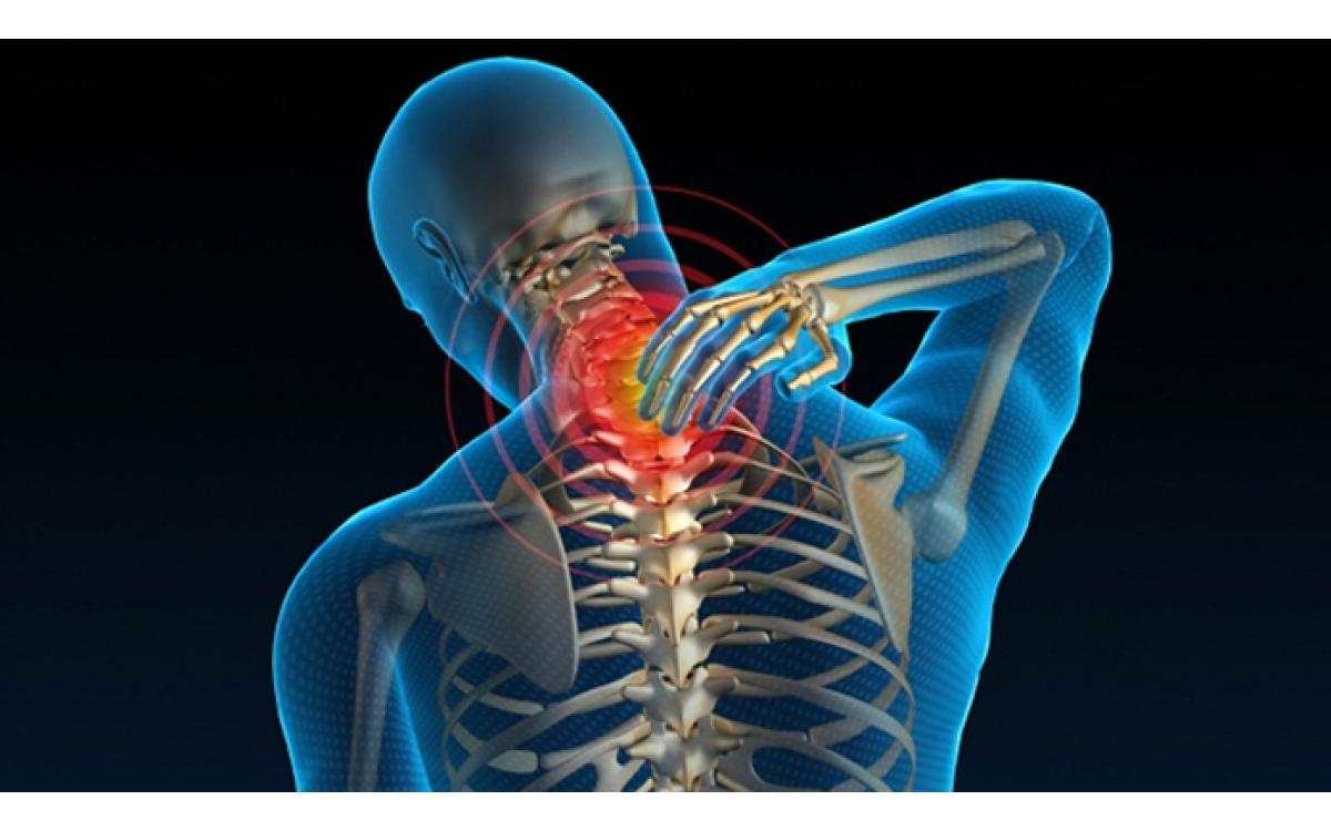 Dấu hiệu nhận biết bệnh thoái hóa đốt sống cổ