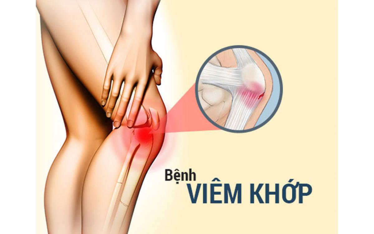 DẤU HIỆU ĐAU KHỚP GỐI KHI ĐỨNG LÊN NGỒI XUỐNG CẢNH BÁO ĐIỀU GÌ?